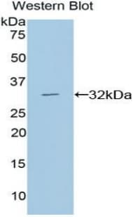 DGKA Antibody (aa312-557)