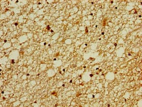 Polyclonal Rabbit anti-Human ZNF488 Antibody