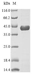 Mouse DHODH Protein (Recombinant 6His, C-terminus)