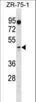 PBX2 Antibody (aa181-210)