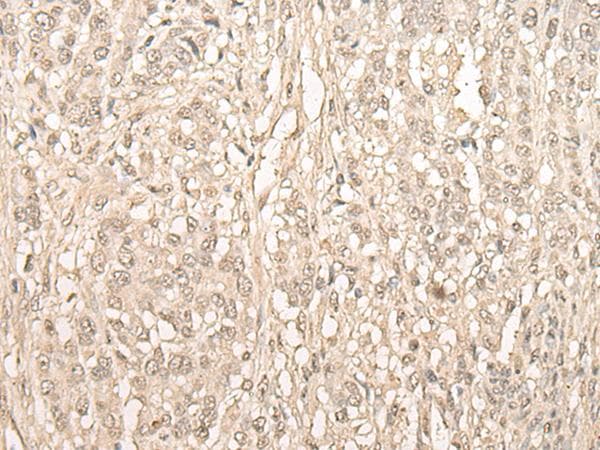 FYTTD1 Antibody