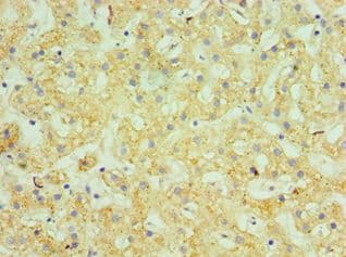 GUSB / Beta Glucuronidase Antibody (aa382-651)