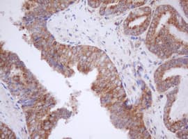 IF3mt / MTIF3 Antibody (aa56-278, clone OTI4B6)