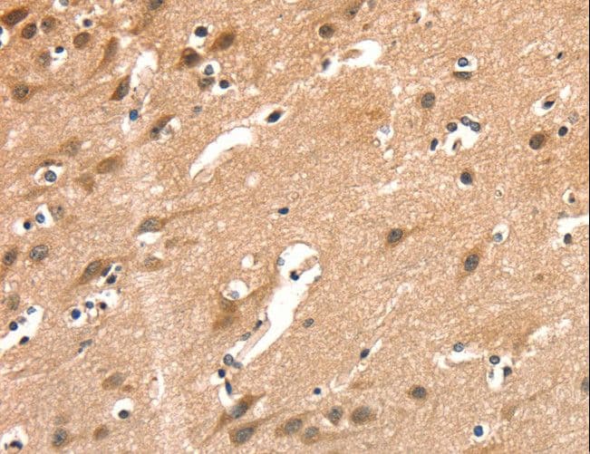 AIMP1 / EMAP II Antibody