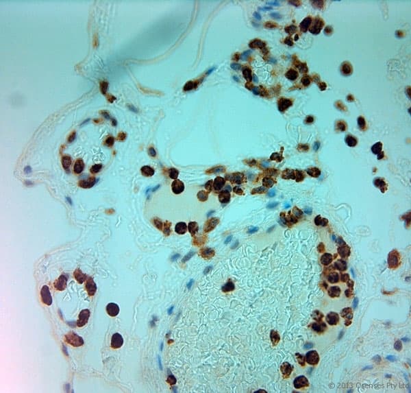 MPO / Myeloperoxidase Antibody