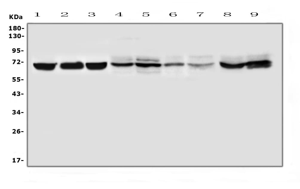 Polyclonal Rabbit anti-Human IFNAR1 / IFNAR Antibody (WB)
