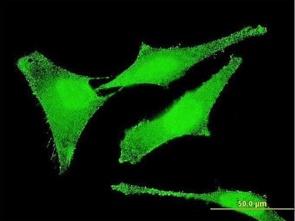 SET / TAF-I Antibody (clone M1-F5)