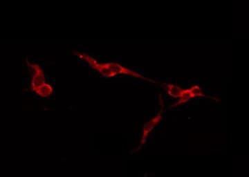 ACAN / Aggrecan Antibody