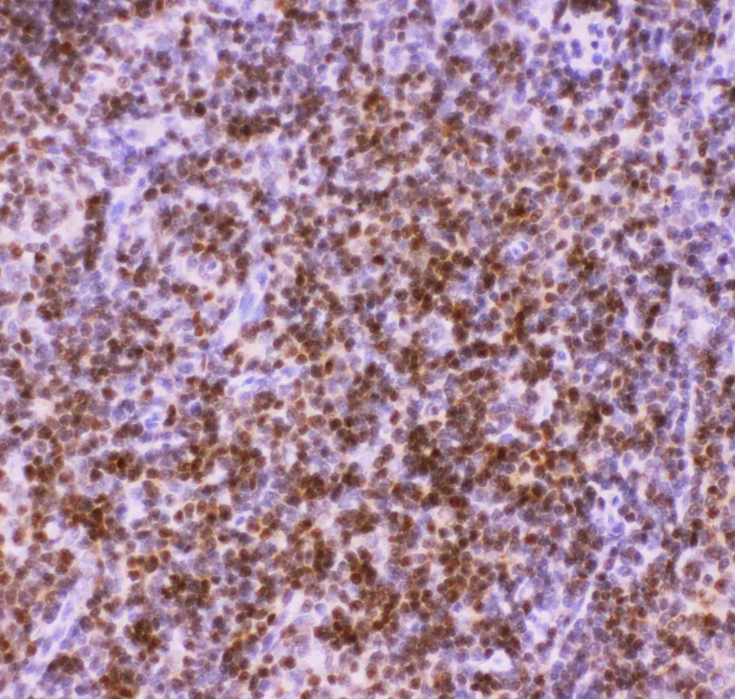 AML1 / RUNX1 Antibody (aa200-233)