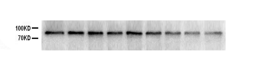 Polyclonal Rabbit anti-Human SOX5 Antibody (aa495-528, WB)