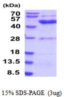 Human ETNK2 Protein (Recombinant His)