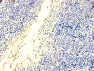 DNTT / TdT Antibody