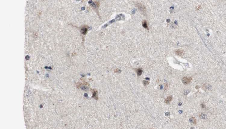 Polyclonal Rabbit anti-Human PDE4B+C+D Antibody (IHC, IF, WB)