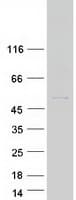 Human OVCA1 / DPH1 Protein (Recombinant Myc-DDK (Flag))