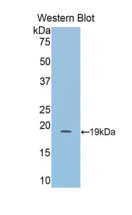 LCAT Antibody (aa290-434)