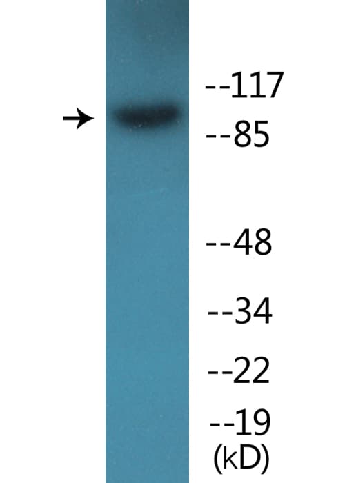 ITGB1 / Integrin Beta 1 / CD29 Antibody (phospho-Thr789)