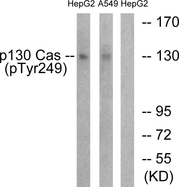 BCAR1 / p130Cas Antibody (phospho-Tyr249)