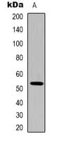Monoclonal Mouse anti-Human TP53 / p53 Antibody (IHC, IF, WB)