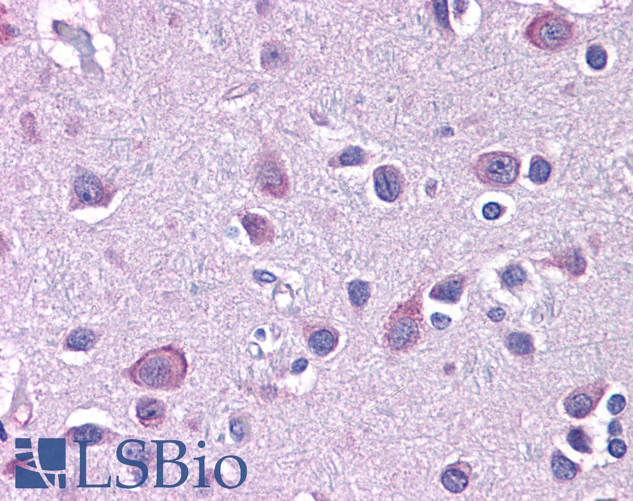 IHC-plus™ Polyclonal Rabbit anti-Human USP10 Antibody (IHC, IF, WB)