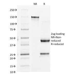 ITGB3 / Integrin Beta 3 / CD61 Antibody (clone Y2/51, Azide-free, BSA-free)
