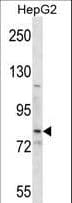 SMO / Smoothened Antibody (aa539-567)