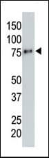 Hemagglutinin / HA Tag Antibody