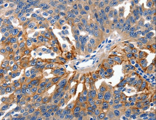 CLDN1 / Claudin 1 Antibody
