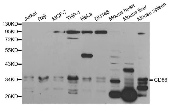 IHC-plus™ Polyclonal Rabbit anti-Human CD86 Antibody (IHC, IF, WB)