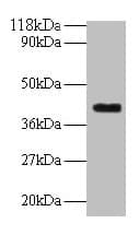 IHC-plus™ Polyclonal Rabbit anti-Human ELAVL2 / HUB Antibody (IHC, WB)
