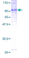 Human ICAM-1 / CD54 Protein (Recombinant GST)