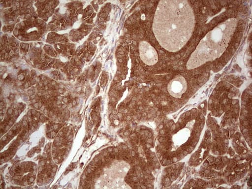 UBE2D2 / UBCH5B Antibody (clone OTI2C2, Carrier-free)