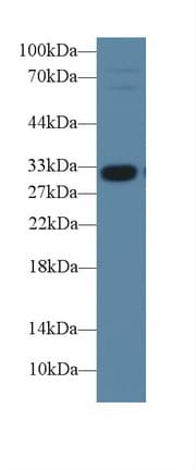 IGFBP1 Antibody (aa112-262, FITC)