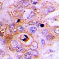 FECH / Ferrochelatase Antibody