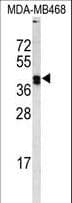 LOX / Lysyl Oxidase Antibody (aa234-260)