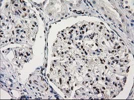 PRKCE / PKC-Epsilon Antibody (clone OTI2A12)