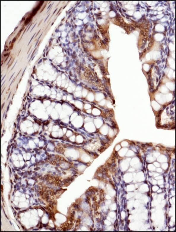 TNF Alpha Antibody (aa100-200)