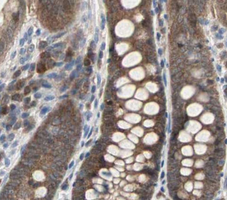 CASP3 / Caspase 3 Antibody