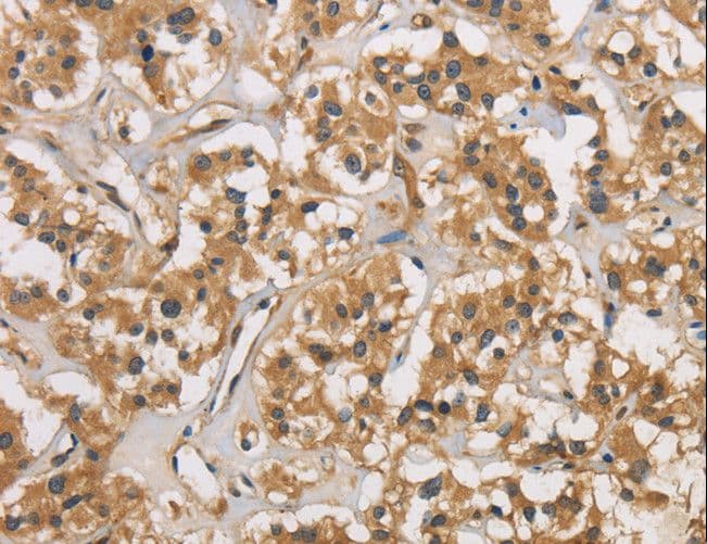 CASP3 / Caspase 3 Antibody