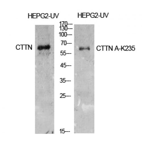 CTTN / Cortactin Antibody (Internal)