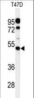 PIGM Antibody (aa394-423)