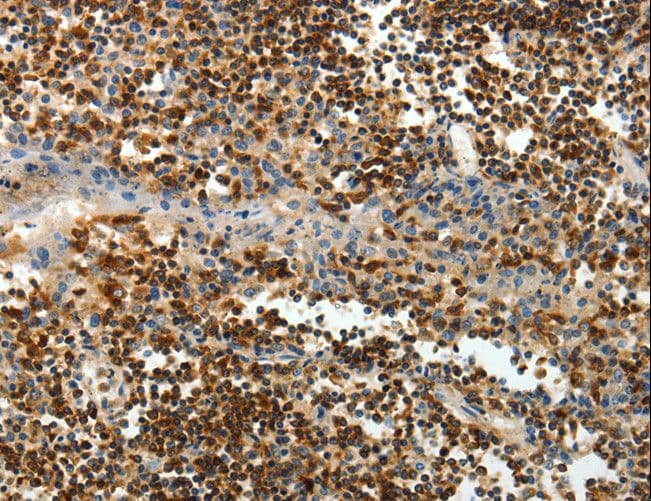 Polyclonal Rabbit anti-Human AMD / AMD1 Antibody (IHC)