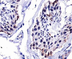 DUX4 Antibody (C-Terminus, clone P4H2)