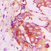 Polyclonal Rabbit anti-Human TTF / RHOH Antibody (C-Terminus, IHC, WB)