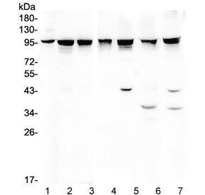 PDCD6IP / ALIX Antibody