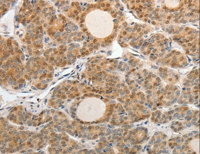 ASCL1 / MASH1 Antibody