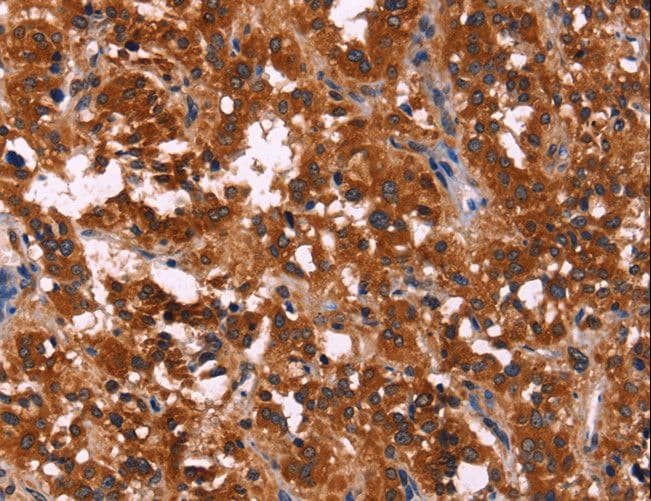Polyclonal Rabbit anti-Human RPSA / Laminin Receptor Antibody (IHC, WB)