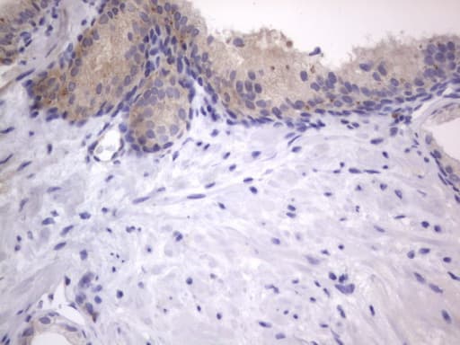 ARAF / ARAF1 / A-RAF Antibody (aa145-365, clone OTI2F8, Carrier-free)