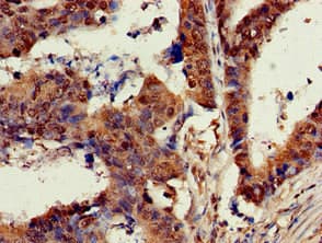 KRAS Antibody (aa2-168)