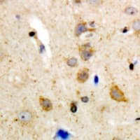 Polyclonal Rabbit anti-Human BLK Antibody (C-Terminus, IHC, WB)