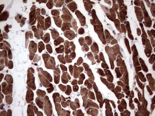 TNNT2 / CTNT Antibody (clone OTI7A1)
